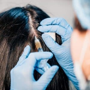 hårtransplantation metoder